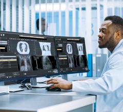 Philips will demonstrate its Multimodality RT Simulation Workspace, a precision medicine application that provides a vendor-agnostic single space for simulation, multimodality image fusion and contouring