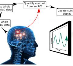 Neurofeedback Shows Promise in Treating Tinnitus