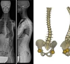 sterEOS 1.5 Orthopedic Imaging X-Ray EOS Imaging 