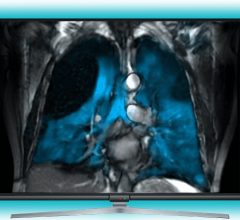 Two best-in-class lung imaging companies combine expertise for the deployment of xenon 129 MRI platform 