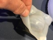 An example of flexible bolus made from silicone on molds that were 3-D printed from patient CT scans. These are very flexible, so more comfortable fro the patient. These are used to attenuate electron beam radiation therapy doses in treating skin cancers. This a new product, FlexiBol, is from Decimal at ASTRO 2021. 