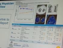 An example of how prior images for a cancer patient can be called up and embedded into a radiology report using an artificial intelligence driven software from Carestream. Radiologist Cree Gaskin, M.D., University of Virginia, explained in sessions how new enterpise imaging software allows key images and links to prior exams to be embedded into radiology reports.