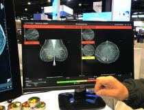 MammoScreen's artificial intelligence for mammography. The system shows the AI analysis on a different screen for the radiologist rather than embedding it on the mammograms. This allows the radiologist to review it after they read the study to serve as a second set of eyes.