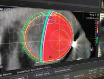 Proton therapy for the eye treatment plan shown by RaySearch at AAPM 2019. #AAPM2019 #AAPM