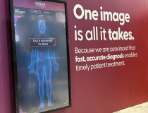 At Agfa’s Radiological Society of North America’s (RSNA) booth, radiology professionals discovered intelligent radiography powered by the MUSICA Acquisition Workstation