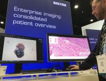 Newer enterprise imaging platforms enable storage of all types of non-DICOM data and images. This example from Sectra shows its system can pull up digital pathology slides and available light JPEG images of a suspected skin cancer. Hospitals are looking at enterprise imaging solutions to enable better images and report sharing across various departments beyond radiology and cardiology and into the EMR. #RSNA #pathology #digitalpathology #RSNA21