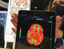 A demonstration of how advanced visualization reconstructions on the TeraRecon iNtuition system can easily be viewed and shared on a mobile device. The company has been very involved in AI the past few years at RSNA, but refocused attention on its third-party advanced visualization platform this year.  