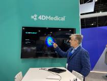 Founder and CEO of medical technology company 4D Medical, Andreas Fouras, explains the features of the XV Scanner unveiled at RSNA 2022.