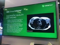 MRIdian's SmartVISION provides high-definition, diagnostic-quality MR imaging. SmartVISION was designed to maintain high-fidelity beam delivery while mitigating the risks of skin toxicities, as well as trapped or distorted dose. 