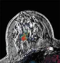 MRI Reaches into Numerous Arenas