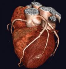 Cross-training physicians would close the gap between reading complex cardiac CT exams and a standard chest CT exam. Photo courtesy of Toshiba America Medical Systems.