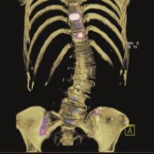 Biomarkers Key to Drug Development