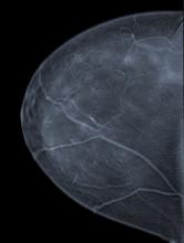 FDA MQSA Mammography Full-Field Digital FFDM Women's Health 