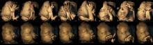 4-D scans, fetuses, smoking, effects, unborn babies, Durham, Lancaster