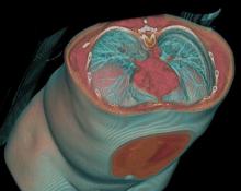 American College of Radiology ACR CT Systems Imaging