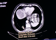 AI, deep learning, artificial intelligence, medical imaging, radiology