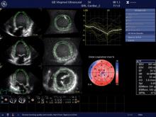 cardiac ultrasound