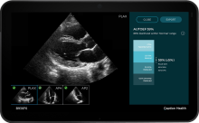 Acquisition supports GE HealthCare’s $3 billion Ultrasound business by adding AI-enabled image guidance to ultrasound device portfolios