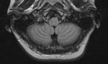 MRI, gadolinium, contrast agents, Wolters Kluwer, safety issue