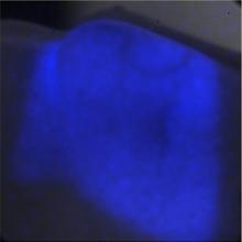 light therapy, radiation oncology, radiopharmaceuticals, PET