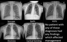 children, x-rays, Mayo Clinic, unnecessary, RSNA 2014, study