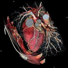 Imaging Outlook 2010