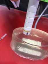 The Cianna/Merit Medical breast tumor location system that uses a radar based fiducial marker. The Scout system uses a marker that is needle injected into the tumor. A wand is moved over the breast. As it come close to the marker it makes a tone, which gets louder as the wand gets closer and is on top of the marker. The console showed the depth from the skin surface to the marker. 