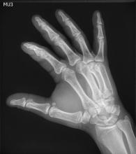 digital radiography, DR, Agfa, Musica