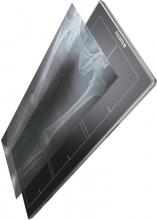 flat panel detector, Fujifilm, FDR DEVO, DR, digital radiography