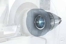 radiosurgery, Gamma Knife, 