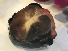 Life-like, realistic 3-D printed anatomy and gross pathology is a new trend at the 2019 Radiological Society Of North America (RSNA) meeting. 