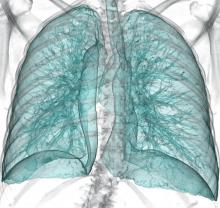 Lung Cancer CT Screening American College of Radiology
