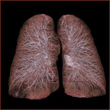imaging ct systems acr computed tomography