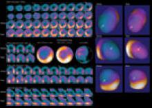 A novel imaging agent for PET, BMS747158 detects more ischemia than technetium SPECT/CT imaging.