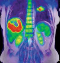 The Potential of PET/MR