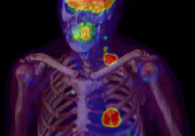 nuclear imaging spect spect/ct IMV