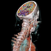 Imaging Outlook 2010