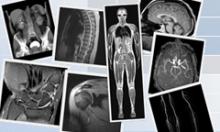 National Radiology Quality Assurance Service Launched 