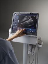 2013 Ultrasound Market Report Klein Biomedical Consultants Inc.