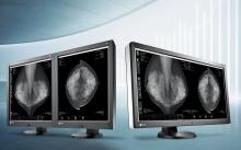 RadiForce GX540, Eizo