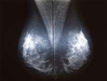 NovaMG, Novarad, PACS