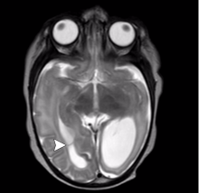 Zika virus, imaging zika, CT scans of Zika, MRI scans of zika, radiology of Zika, medical imaging of zika