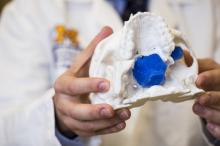 3-d printing, tumor