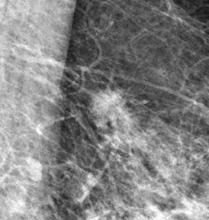 The same object is more detectable when the overall image contrast is higher, as shown in this high-contrast image.