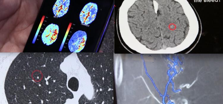 Examples of artificial intelligence (AI) being used in medical imaging, radiology.