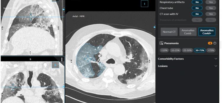 Computed Tomography Ct Imaging Technology News