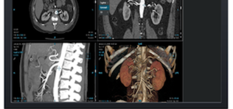 GE HealthCare to Highlight  Advanced Enterprise Imaging with Cloud-Enabled Solutions