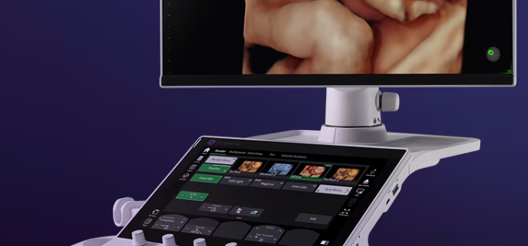 GE HealthCare Introduces Next Evolution of its AI-enabled Voluson Performance Series
