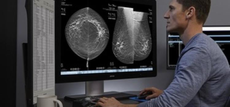 Study: AI-Powered Mammography Technology Helps Flag Breast Cancer Cases Initially Interpreted as Negative 