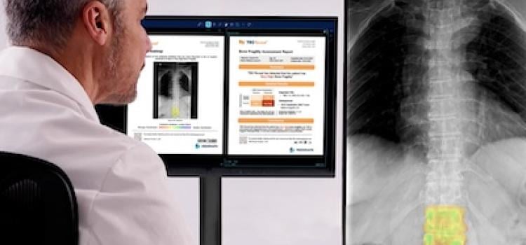 Medimaps Group to Premier AI Software for X-ray Scans at RSNA 2025